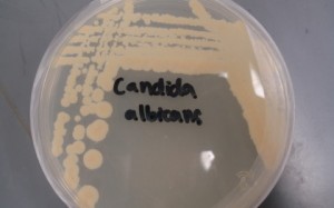 CandidaAlbicans-480x300